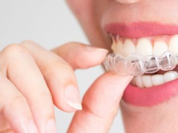 Invisalign / ClearCorrect